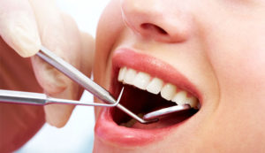 lechenie-zubov